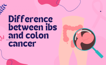 difference between ibs and colon cancer